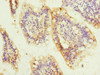 Immunohistochemistry of paraffin-embedded human small intestine tissue using CSB-PA887948ESR2HU at dilution of 1:100