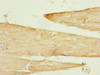 Immunohistochemistry of paraffin-embedded human skeletal muscle tissue using CSB-PA896898ESR2HU at dilution of 1:100