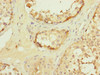 Immunohistochemistry of paraffin-embedded human testis tissue using CSB-PA623014DSR1HU at dilution of 1:100