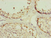 Immunohistochemistry of paraffin-embedded human testis tissue using CSB-PA623014DSR2HU at dilution of 1:100