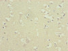 Immunohistochemistry of paraffin-embedded human brain tissue using CSB-PA002355ESR2HU at dilution of 1:100