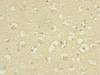 Immunohistochemistry of paraffin-embedded human brain tissue using CSB-PA002366ESR2HU at dilution of 1:100