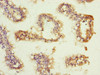 Immunohistochemistry of paraffin-embedded human small intestine tissue using CSB-PA002366ESR2HU at dilution of 1:100