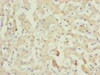 Immunohistochemistry of paraffin-embedded human liver tissue using CSB-PA004194ESR1HU at dilution of 1:100
