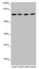 Western blot<br />
 All lanes: C8B antibody at 1.28µg/ml<br />
 Lane 1: Hela whole cell lysate<br />
 Lane 2: Jurkat whole cell lysate<br />
 Lane 3: Raji whole cell lysate<br />
 Lane 4: Mouse liver tissue<br />
 Secondary<br />
 Goat polyclonal to rabbit IgG at 1/10000 dilution<br />
 Predicted band size: 67 kDa<br />
 Observed band size: 67 kDa<br />