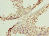 Immunohistochemistry of paraffin-embedded human testis tissue using CSB-PA892451ESR1HU at dilution of 1:100