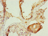 Immunohistochemistry of paraffin-embedded human testis tissue using CSB-PA892451ESR2HU at dilution of 1:100