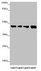 Western blot<br />
 All lanes: FBXO22 antibody at 1.98µg/ml<br />
 Lane 1: Mouse heart tissue<br />
 Lane 2: Hela whole cell lysate<br />
 Lane 3: MCF-7 whole cell lysate<br />
 Lane 4: HepG2 whole cell lysate<br />
 Secondary<br />
 Goat polyclonal to rabbit IgG at 1/10000 dilution<br />
 Predicted band size: 45, 5, 31 kDa<br />
 Observed band size: 45 kDa<br />