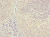 Immunohistochemistry of paraffin-embedded human tonsil tissue using CSB-PA854115ESR1HU at dilution of 1:100