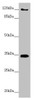 Western blot<br />
 All lanes: FBXO6 antibody at 3.87 µg/ml + A431 whole cell lysate<br />
 Secondary<br />
 Goat polyclonal to rabbit IgG at 1/10000 dilution<br />
 Predicted band size: 34 kDa<br />
 Observed band size: 34, 120 kDa<br />