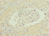 Immunohistochemistry of paraffin-embedded human kidney tissue using CSB-PA873634ESR1HU at dilution of 1:100