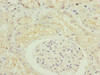 Immunohistochemistry of paraffin-embedded human kidney tissue using CSB-PA873634ESR2HU at dilution of 1:100