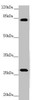 Western blot<br />
 All lanes: MID2 antibody at 3.32 µg/ml + Mouse small intestine tissue<br />
 Secondary<br />
 Goat polyclonal to rabbit IgG at 1/10000 dilution<br />
 Predicted band size: 84, 80 kDa<br />
 Observed band size: 84, 30 kDa<br />