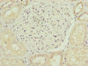 Immunohistochemistry of paraffin-embedded human kidney tissue using CSB-PA892324ESR1HU at dilution of 1:100