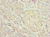 Immunohistochemistry of paraffin-embedded human pancreatic tissue using CSB-PA892324ESR1HU at dilution of 1:100