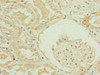 Immunohistochemistry of paraffin-embedded human kidney tissue using CSB-PA892324ESR2HU at dilution of 1:100