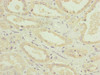 Immunohistochemistry of paraffin-embedded human kidney tissue using CSB-PA883413ESR2HU at dilution of 1:100