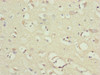 Immunohistochemistry of paraffin-embedded human brain tissue using CSB-PA015642ESR1HU at dilution of 1:100