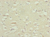 Immunohistochemistry of paraffin-embedded human brain tissue using CSB-PA015642ESR2HU at dilution of 1:100