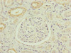 Immunohistochemistry of paraffin-embedded human kidney tissue using CSB-PA015652ESR1HU at dilution of 1:100