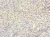 Immunohistochemistry of paraffin-embedded human spleen tissue using CSB-PA015652ESR1HU at dilution of 1:100
