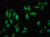 Immunofluorescent analysis of Hela cells using CSB-PA015652ESR1HU at dilution of 1:100 and Alexa Fluor 488-congugated AffiniPure Goat Anti-Rabbit IgG (H+L)