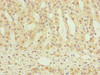 Immunohistochemistry of paraffin-embedded human adrenal gland tissue using CSB-PA015665DSR1HU at dilution of 1:100