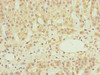 Immunohistochemistry of paraffin-embedded human adrenal gland tissue using CSB-PA015665DSR2HU at dilution of 1:100