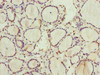 Immunohistochemistry of paraffin-embedded human thyroid tissue using CSB-PA019816ESR1HU at dilution of 1:100