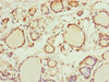 Immunohistochemistry of paraffin-embedded human thyroid tissue using CSB-PA019816ESR2HU at dilution of 1:100
