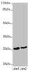 Western blot<br />
 All lanes: RNF114 antibody at 1.63µg/ml<br />
 Lane 1: 293T whole cell lysate<br />
 Lane 2: HepG2 whole cell lysate<br />
 Secondary<br />
 Goat polyclonal to rabbit IgG at 1/10000 dilution<br />
 Predicted band size: 26, 22 kDa<br />
 Observed band size: 26 kDa<br />