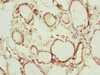 Immunohistochemistry of paraffin-embedded human thyroid tissue using CSB-PA019821ESR1HU at dilution of 1:100
