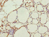 Immunohistochemistry of paraffin-embedded human thyroid tissue using CSB-PA019821ESR2HU at dilution of 1:100