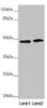 Western blot<br />
 All lanes: RNF135 antibody at 3.51µg/ml<br />
 Lane 1: 293T whole cell lysate<br />
 Lane 2: Jurkat whole cell lysate<br />
 Secondary<br />
 Goat polyclonal to rabbit IgG at 1/10000 dilution<br />
 Predicted band size: 48, 23, 31 kDa<br />
 Observed band size: 48 kDa<br />