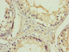 Immunohistochemistry of paraffin-embedded human testis tissue using CSB-PA880976ESR1HU at dilution of 1:100