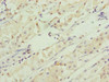 Immunohistochemistry of paraffin-embedded human gastric cancer using CSB-PA857879DSR2HU at dilution of 1:100