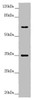Western blot<br />
 All lanes: TRIM23 antibody at 4.55 µg/ml + Raw264.7 whole cell lysate<br />
 Secondary<br />
 Goat polyclonal to rabbit IgG at 1/10000 dilution<br />
 Predicted band size: 65, 64, 62 kDa<br />
 Observed band size: 65, 35 kDa<br />
