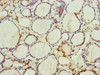 Immunohistochemistry of paraffin-embedded human thyroid tissue using CSB-PA024459ESR1HU at dilution of 1:100