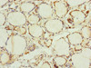 Immunohistochemistry of paraffin-embedded human thyroid tissue using CSB-PA024459ESR2HU at dilution of 1:100