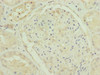 Immunohistochemistry of paraffin-embedded human kidney tissue using CSB-PA883650ESR1HU at dilution of 1:100