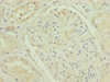 Immunohistochemistry of paraffin-embedded human kidney tissue using CSB-PA883650ESR1HU at dilution of 1:100 Immunohistochemistry of paraffin-embedded human kidney tissue using CSB-PA883650ESR1HU at dilution of 1:100