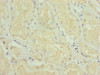 Immunohistochemistry of paraffin-embedded human kidney tissue using CSB-PA883650ESR2HU at dilution of 1:100