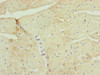 Immunohistochemistry of paraffin-embedded human heart tissue using CSB-PA890670ESR1HU at dilution of 1:100