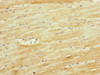 Immunohistochemistry of paraffin-embedded human heart tissue using CSB-PA890670ESR2HU at dilution of 1:100