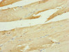 Immunohistochemistry of paraffin-embedded human skeletal muscle tissue using CSB-PA890670ESR2HU at dilution of 1:100