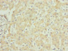 Immunohistochemistry of paraffin-embedded human liver tissue using CSB-PA025667ESR2HU at dilution of 1:100