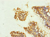 Immunohistochemistry of paraffin-embedded human small intestine tissue using CSB-PA025667ESR2HU at dilution of 1:100