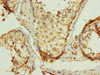 Immunohistochemistry of paraffin-embedded human testis tissue using CSB-PA025668ESR1HU at dilution of 1:100