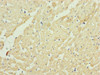 Immunohistochemistry of paraffin-embedded human heart tissue using CSB-PA025668ESR1HU at dilution of 1:100