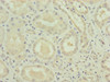Immunohistochemistry of paraffin-embedded human kidney tissue using CSB-PA887959ESR1HU at dilution of 1:100